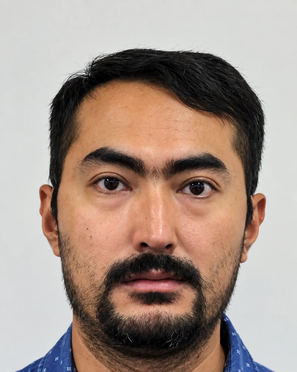 Mr Anish Maharjan, Dental Prosthetist at Village Dental Clinic